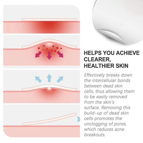 West Month  Repair Pimples Invisible Concealer Breathable Acne Patch