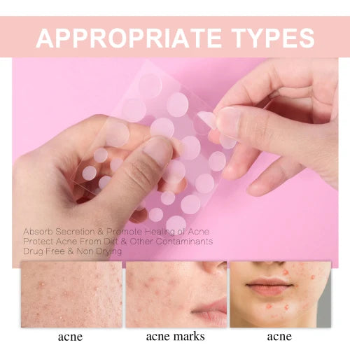 West Month  Repair Pimples Invisible Concealer Breathable Acne Patch