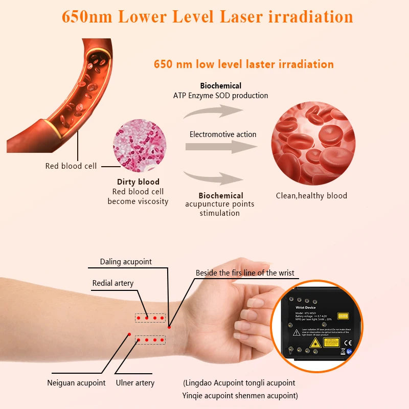 LLLT Cold Laser Physiotherapy Wrist Watch Nose Treatment Rhinitis Red Infrared Light Therapy Machine Smartwatch Pain Relief